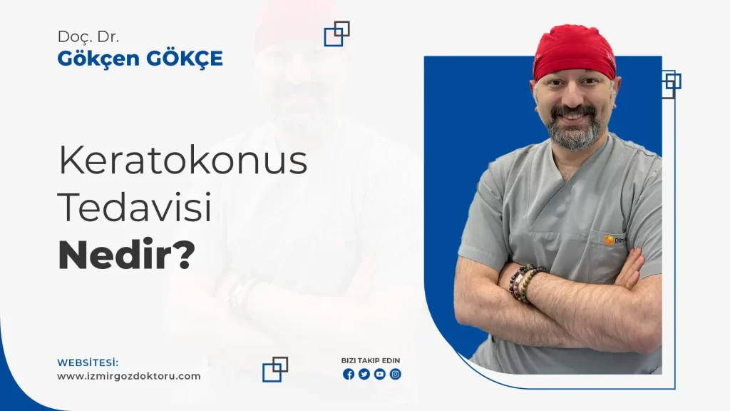Keratokonus Tedavisi Nedir?